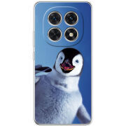 Чохол BoxFace Xiaomi Redmi Note 15 5G 