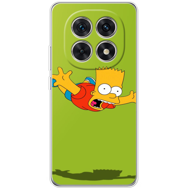 Чохол BoxFace Xiaomi Redmi Note 15 5G 