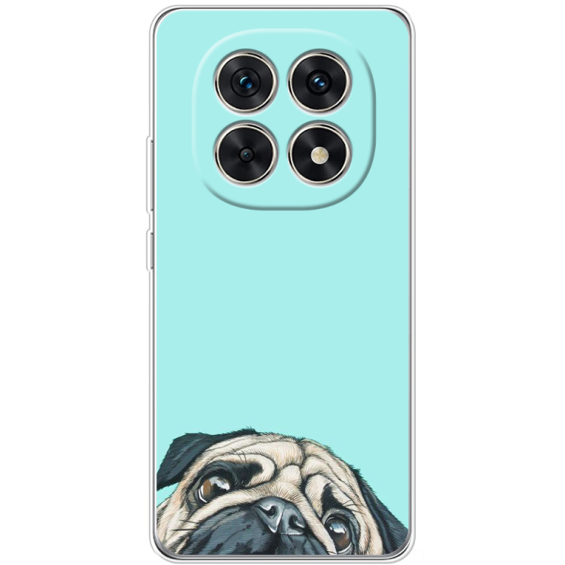 Чохол BoxFace Xiaomi Redmi Note 15 5G 