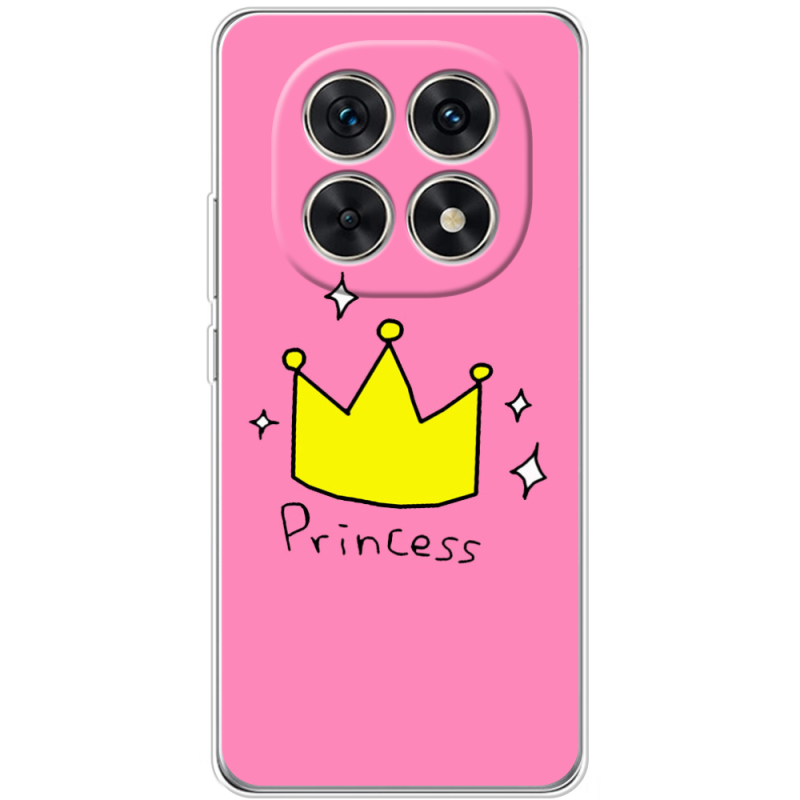 Чохол BoxFace Xiaomi Redmi Note 15 5G 