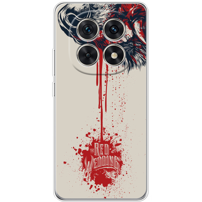 Чохол BoxFace Xiaomi Redmi Note 15 5G 