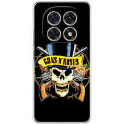 Чохол BoxFace Xiaomi Redmi Note 15 5G 