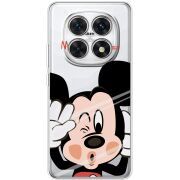 Прозорий чохол BoxFace Xiaomi Redmi Note 15 5G Mister M