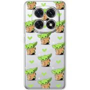Прозорий чохол BoxFace Xiaomi Redmi Note 15 5G Pattern Baby Yoda