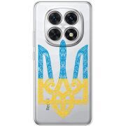 Прозорий чохол BoxFace Xiaomi Redmi Note 15 5G Gold Trident