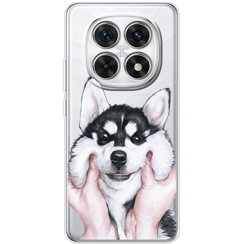 Прозорий чохол BoxFace Xiaomi Redmi Note 15 5G Husky