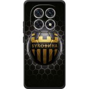 Чорний чохол BoxFace Xiaomi Redmi Note 15 5G 