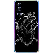 Чехол BoxFace Vivo Y72 5G 