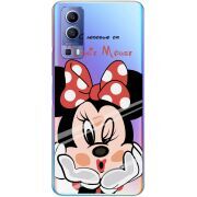 Прозрачный чехол BoxFace Vivo Y72 5G Lady M