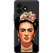 Прозрачный чехол BoxFace Umidigi G5 Mecha Фрида Кало