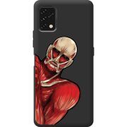 Прозрачный чехол BoxFace Umidigi Power 5S Титан