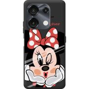 Прозрачный чехол BoxFace Umidigi G9 5G Lady M