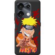 Прозрачный чехол BoxFace Umidigi G9 5G Naruto