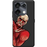 Прозрачный чехол BoxFace Umidigi G9 5G Титан