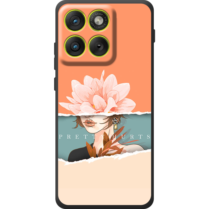 Чохол BoxFace Moto Edge 70 