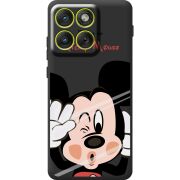 Прозорий чохол BoxFace Moto Edge 70 Mister M