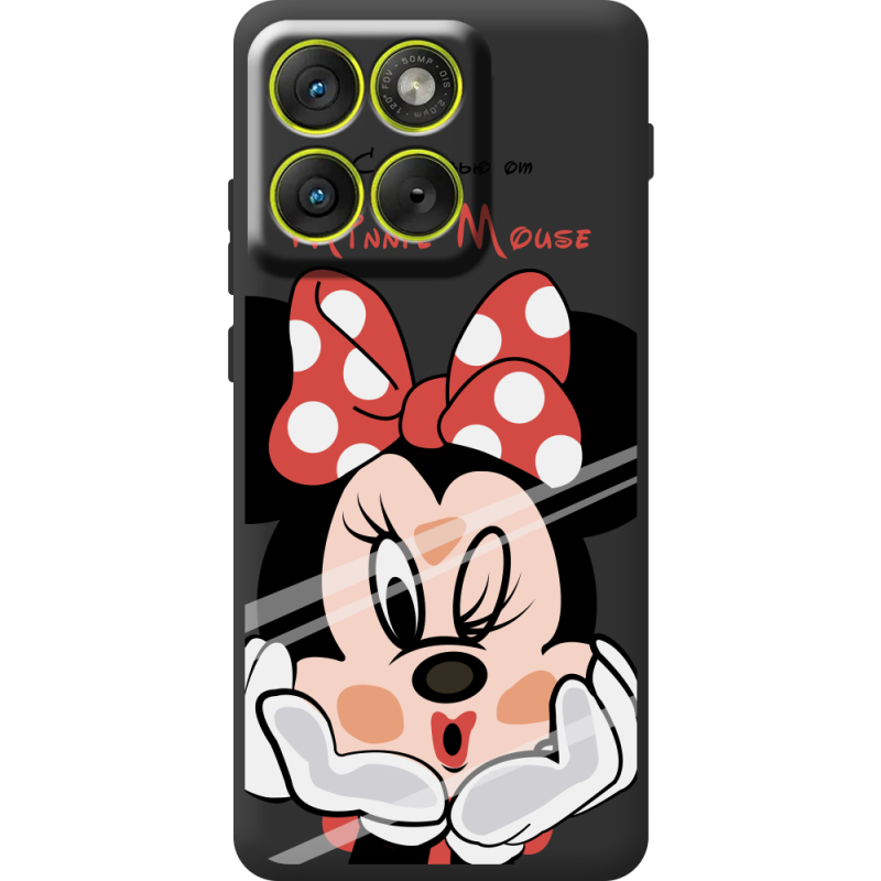 Прозорий чохол BoxFace Moto Edge 70 Lady M