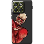 Прозорий чохол BoxFace Moto Edge 70 Титан