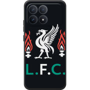 Чохол BoxFace Poco F8 Pro L. F. C.