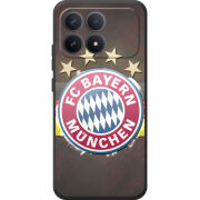 Чохол BoxFace Poco F8 Pro 