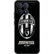 Чохол BoxFace Poco F8 Pro 