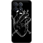 Чохол BoxFace Poco F8 Pro 