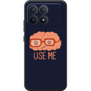 Чохол BoxFace Poco F8 Pro 