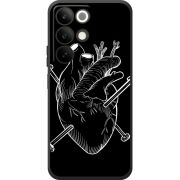 Чохол BoxFace Realme C85 