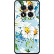 Чохол BoxFace Xiaomi Redmi Note 15 Pro 