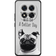 Чохол BoxFace Xiaomi Redmi Note 15 Pro 