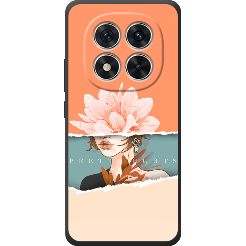 Чохол BoxFace Xiaomi Redmi Note 15 Pro 