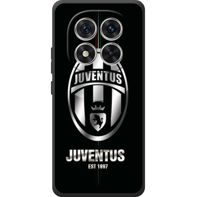 Чохол BoxFace Xiaomi Redmi Note 15 Pro 