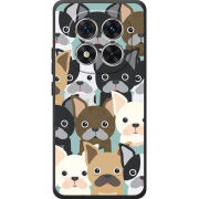 Чохол BoxFace Xiaomi Redmi Note 15 Pro 