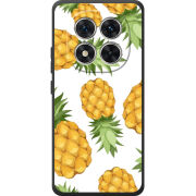 Чохол BoxFace Xiaomi Redmi Note 15 Pro 