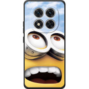 Чохол BoxFace Xiaomi Redmi Note 15 Pro 