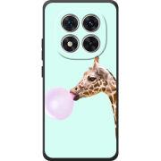 Чохол BoxFace Xiaomi Redmi Note 15 Pro 