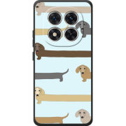 Чохол BoxFace Xiaomi Redmi Note 15 Pro Dachshund