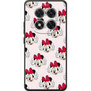 Чохол BoxFace Xiaomi Redmi Note 15 Pro 