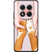 Чохол BoxFace Xiaomi Redmi Note 15 Pro 