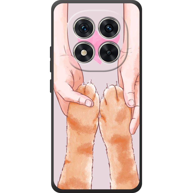 Чохол BoxFace Xiaomi Redmi Note 15 Pro 