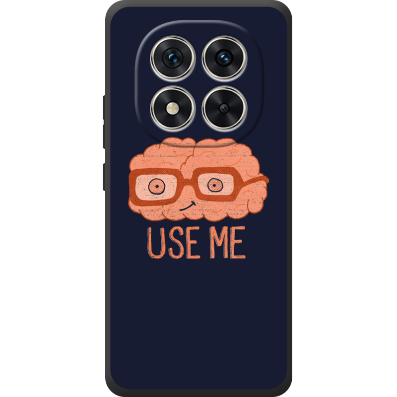 Чохол BoxFace Xiaomi Redmi Note 15 Pro 