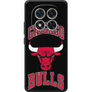 Чохол BoxFace Xiaomi Redmi Note 15 Pro 