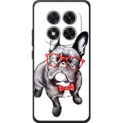 Чохол BoxFace Xiaomi Redmi Note 15 Pro 