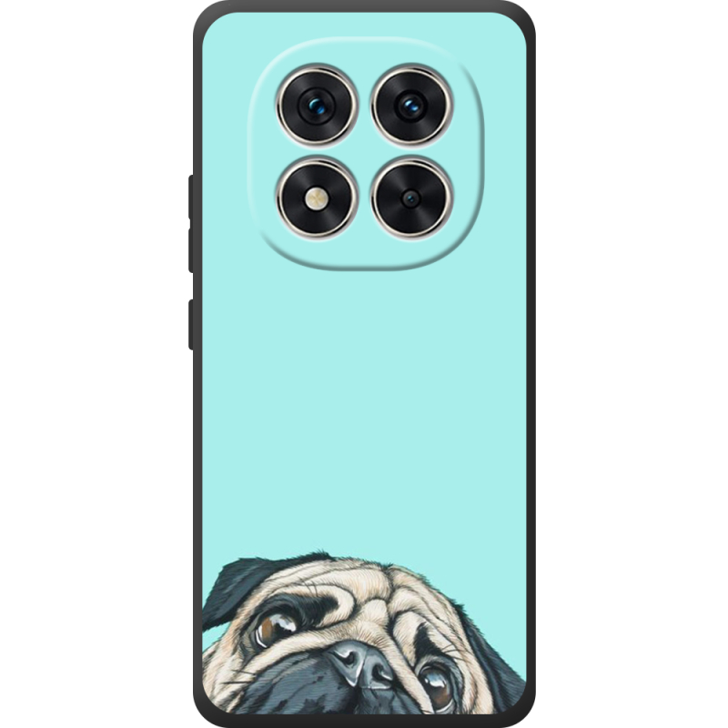 Чохол BoxFace Xiaomi Redmi Note 15 Pro 