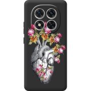 Чохол зі стразами Xiaomi Redmi Note 15 Pro Heart
