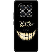 Чохол BoxFace Poco M8 