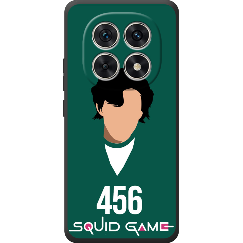 Чохол BoxFace Poco M8 siquid game 456