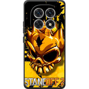 Чохол BoxFace Poco M8 StandOff 2 gold