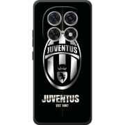 Чохол BoxFace Poco M8 