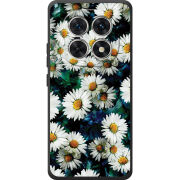 Чохол BoxFace Poco M8 